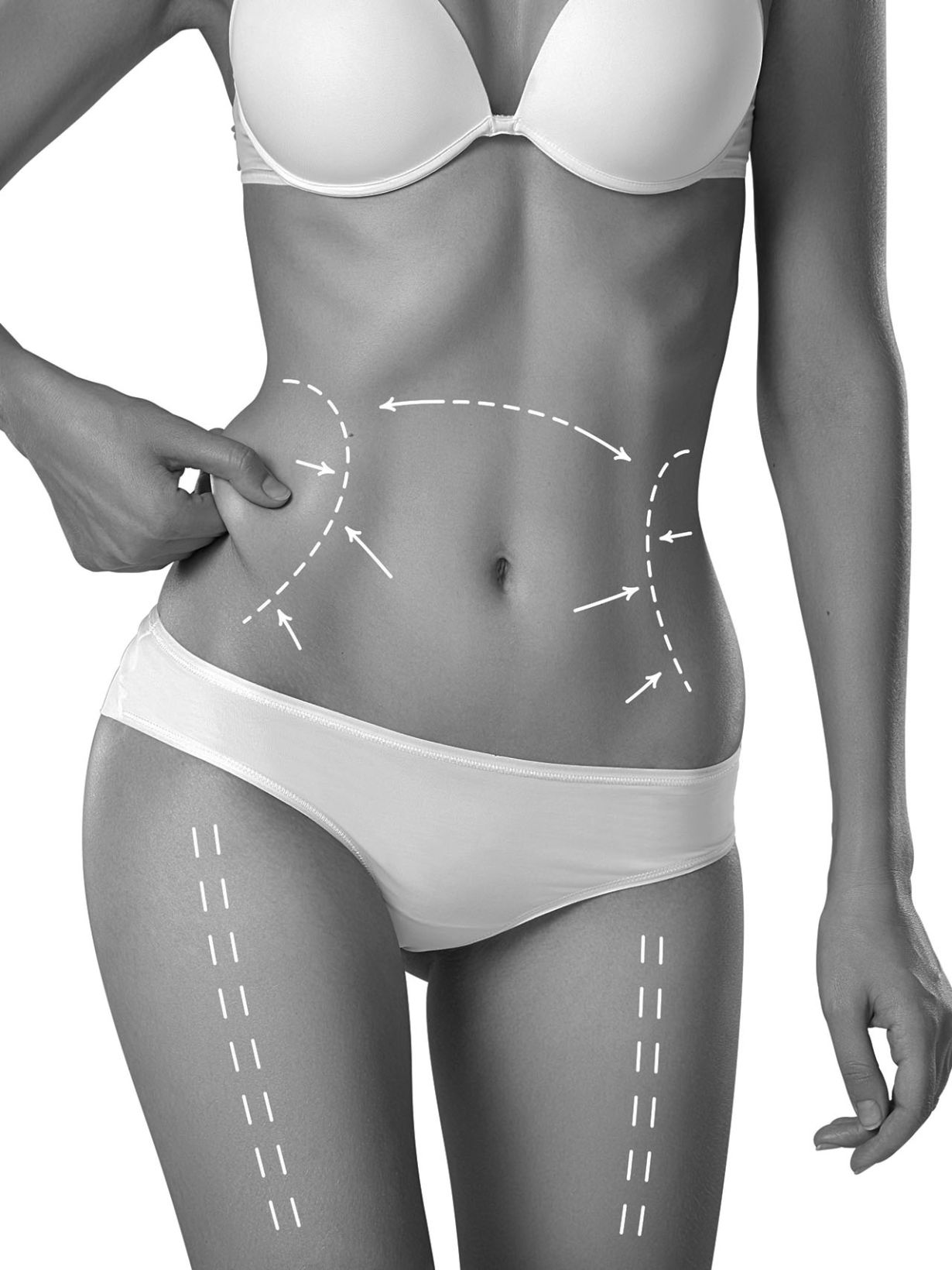 liposuccion vaser en cdmx precio 2024